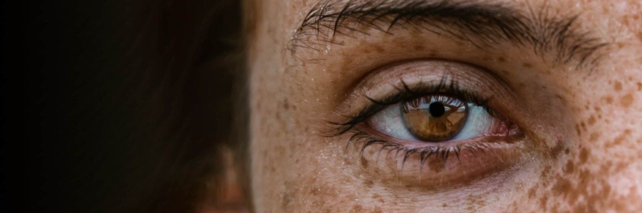 Eye 